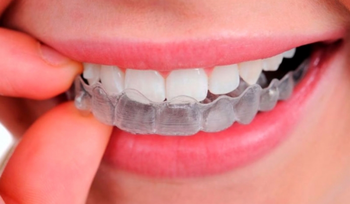 5 consejos para cuidar bien tu férula dental de descarga